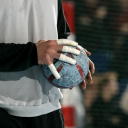 Frode Hagen hat die Finger seiner rechten Wurfhand stark getapet und h�lt damit einen Ball.